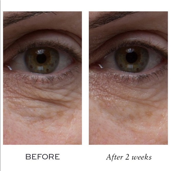 💗ELEMIS Peptide4 Eye Recovery Cream - Picture 6 of 10